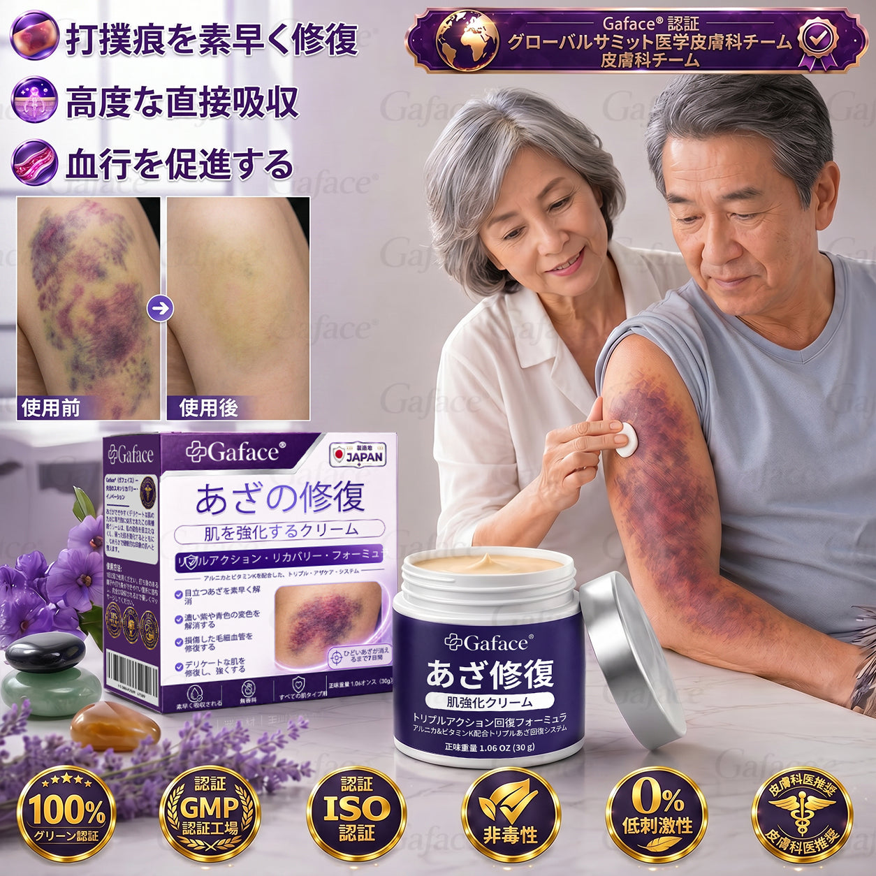 [販売数𝟏𝟏万個以上] 👩‍⚕️☑️𝐆𝐚𝐟𝐚𝐜𝐞®打撲ケア肌強化クリ一ム
