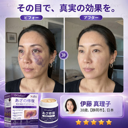 [販売数𝟏𝟏万個以上] 👩‍⚕️☑️𝐆𝐚𝐟𝐚𝐜𝐞®打撲ケア肌強化クリ一ム