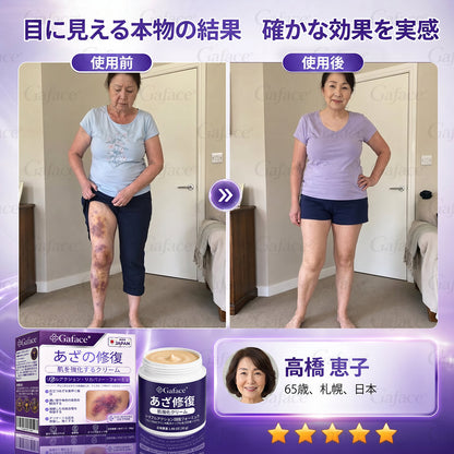 [販売数𝟏𝟏万個以上] 👩‍⚕️☑️𝐆𝐚𝐟𝐚𝐜𝐞®打撲ケア肌強化クリ一ム
