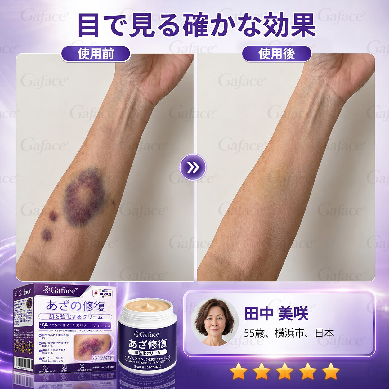 [販売数𝟏𝟏万個以上] 👩‍⚕️☑️𝐆𝐚𝐟𝐚𝐜𝐞®打撲ケア肌強化クリ一ム