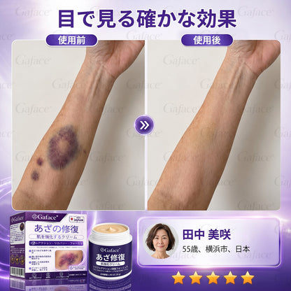 [販売数𝟏𝟏万個以上] 👩‍⚕️☑️𝐆𝐚𝐟𝐚𝐜𝐞®打撲ケア肌強化クリ一ム