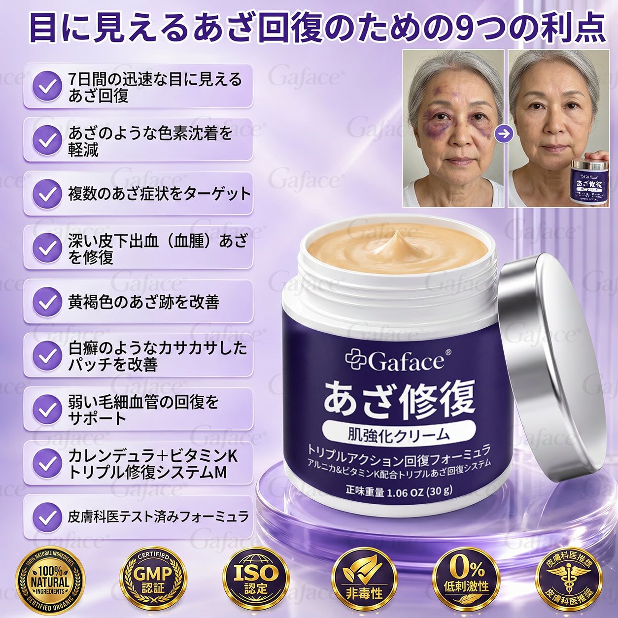 [販売数𝟏𝟏万個以上] 👩‍⚕️☑️𝐆𝐚𝐟𝐚𝐜𝐞®打撲ケア肌強化クリ一ム